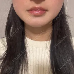 ヴァージンクリニック 福岡天神院口コミ