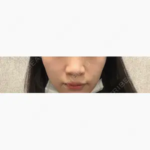 ネビュラクリニック 東京錦糸町院口コミ