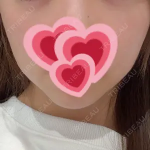 R Beauty CLINIC 大阪院口コミ
