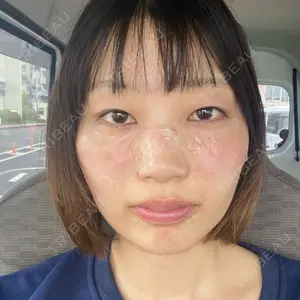 TCB東京中央美容外科 宮崎院口コミ