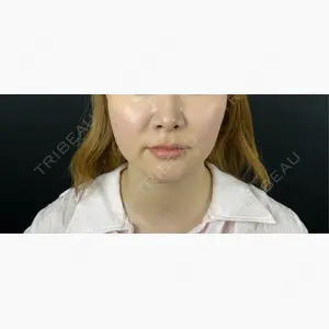 藤・ナチュレ美容クリニック 銀座院口コミ