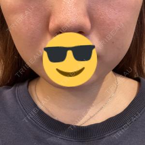 TCB東京中央美容外科 盛岡院口コミ