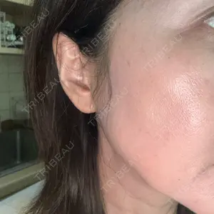 ルラ美容クリニック 新潟院口コミ