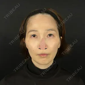 藤・ナチュレ美容クリニック 銀座院口コミ