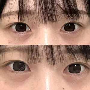 アリエル美容クリニック 大宮院口コミ