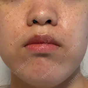 ルラ美容クリニック 池袋院口コミ