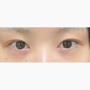 アリエル美容クリニック 水戸院口コミ