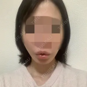 X CLINIC 銀座院口コミ