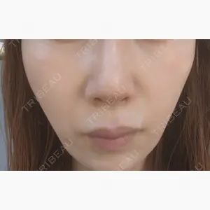 LUNAGE CLINIC（ルナージュクリニック）口コミ