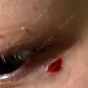 muni skin clinic口コミ