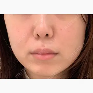 フィラークリニック 新宿院口コミ