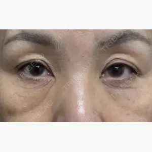 ネビュラクリニック 京都院口コミ