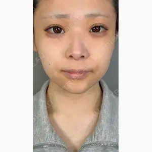 アリエル美容クリニック 大宮院口コミ