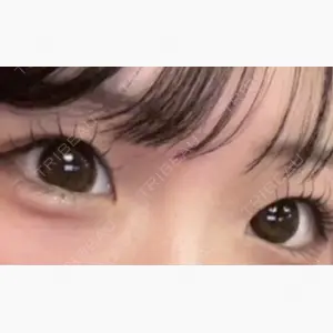 アリエル美容クリニック 郡山院口コミ