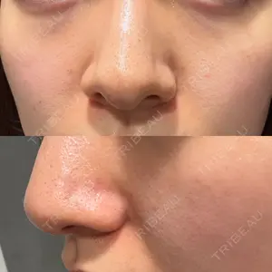 東京美容クリニック 表参道本院口コミ