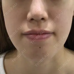 椿クリニック 心斎橋院口コミ