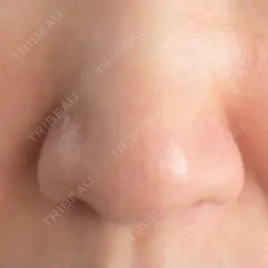 PRO CLINIC プロクリニック 銀座院口コミ