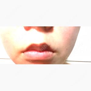 DMTC美容皮膚科 大宮院口コミ