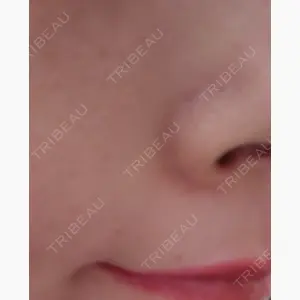 DMTC美容皮膚科 大宮院口コミ