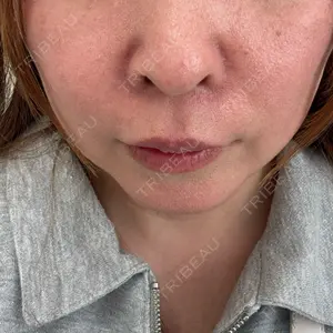 ルラ美容クリニック 神戸院口コミ