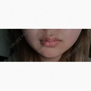 TCB東京中央美容外科 京都駅前院口コミ