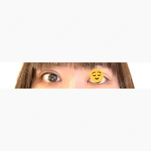 エターナル美容クリニック口コミ