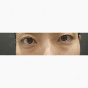 PRO CLINIC プロクリニック 銀座院口コミ