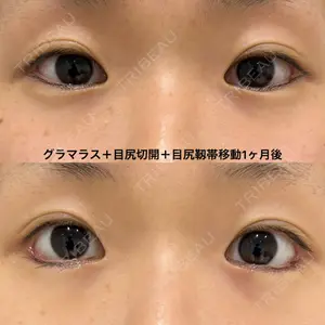 エターナル美容クリニック口コミ