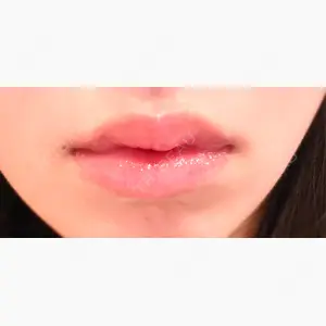 東京BELLEZZAクリニック口コミ