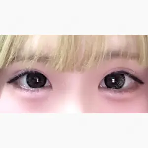 東京シンデレラ美容外科 新宿院口コミ