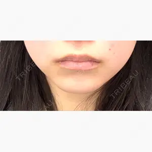 ルラ美容クリニック 大阪本院口コミ