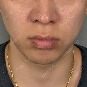 アリエル美容クリニック 大宮院口コミ