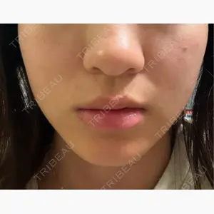 TCB東京中央美容外科 京都駅前院口コミ