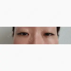 ネビュラクリニック 東京錦糸町院口コミ