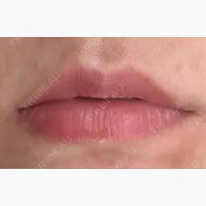 上野美容外科・美容皮膚科口コミ