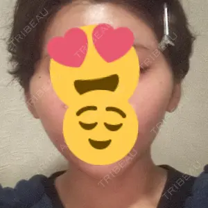 A CLINIC（エークリニック） 仙台院口コミ