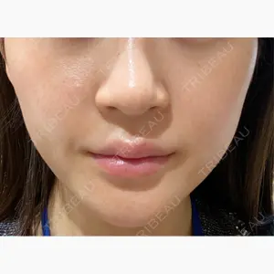 Wi Clinic （ウィ クリニック）心斎橋院口コミ