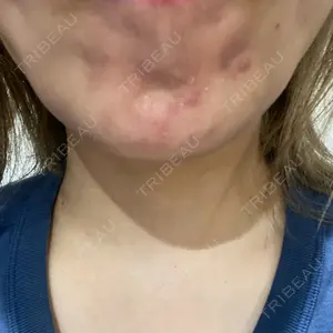 ルラ美容クリニック 広島院口コミ