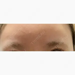 Zetith Beauty Clinic 池袋院口コミ