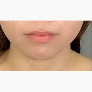 YBC横浜美容外科 立川院口コミ