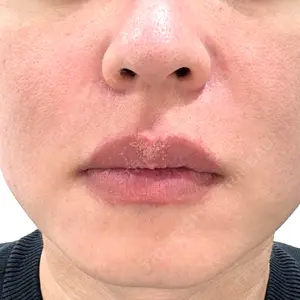 PureMe Skin Clinic（ピュアミースキンクリニック麻布）口コミ