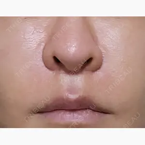 聖心美容クリニック 六本木院口コミ