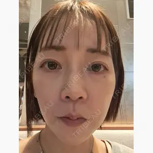 共立美容外科 梅田院口コミ