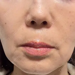 ライブリークリニック 大阪院口コミ