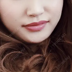 ウィーバー美容外科口コミ