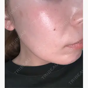 RIN BEAUTY CLINIC口コミ