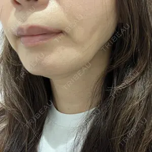 ルラ美容クリニック 渋谷本院口コミ
