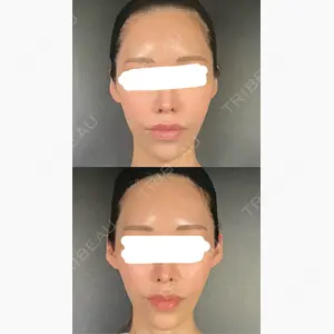 R Beauty CLINIC 銀座院口コミ