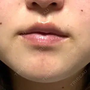 ルラ美容クリニック 岐阜院口コミ