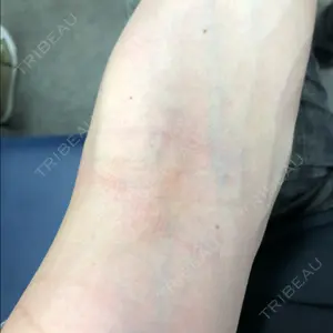 秋葉原スキンクリニック口コミ